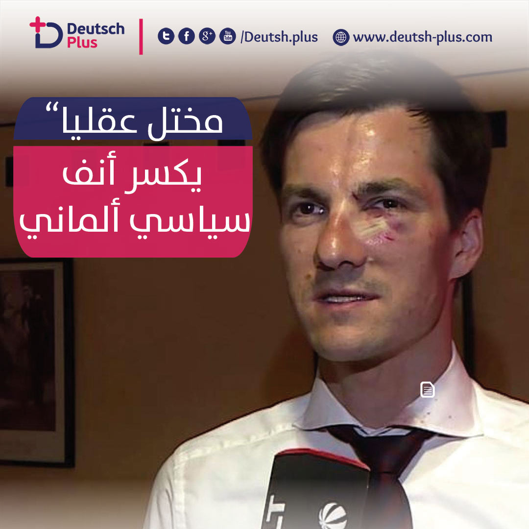 مختل عقليا” يكسر انف و سن سياسي ألماني