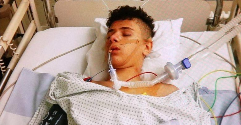 مراهق سوري في حالة غير مستقرة بسبب رفاقه !! ماذا فعلوا به ؟؟؟