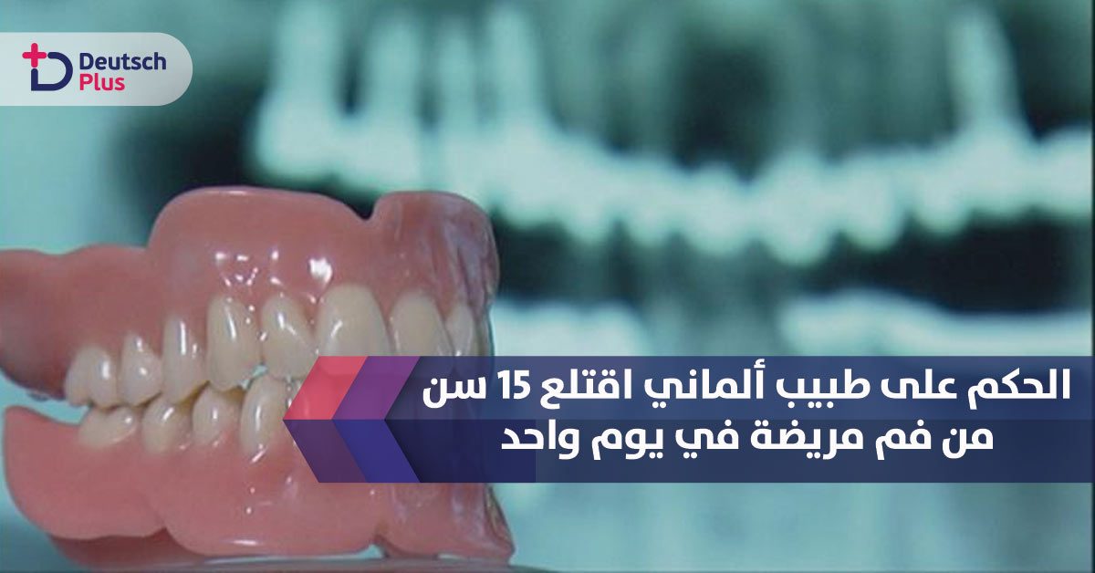 الحكم على طبيب ألماني اقتلع 15 سن من فم مريضة في يوم واحد