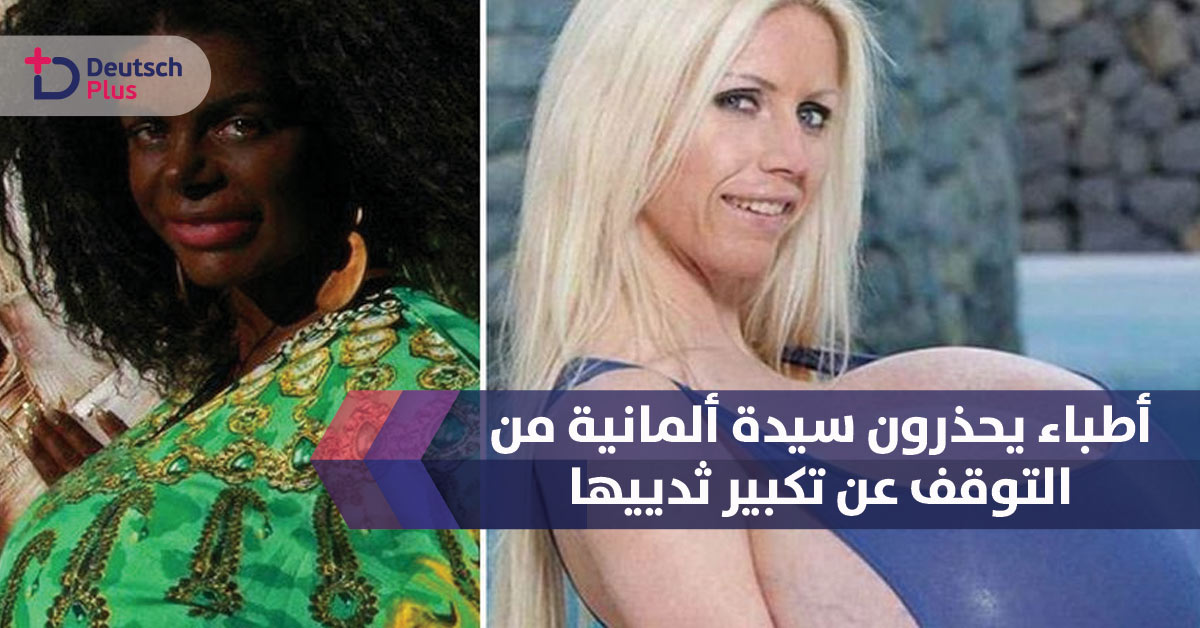 أطباء يحذرون سيدة ألمانية التوقف عن تكبير ثدييها